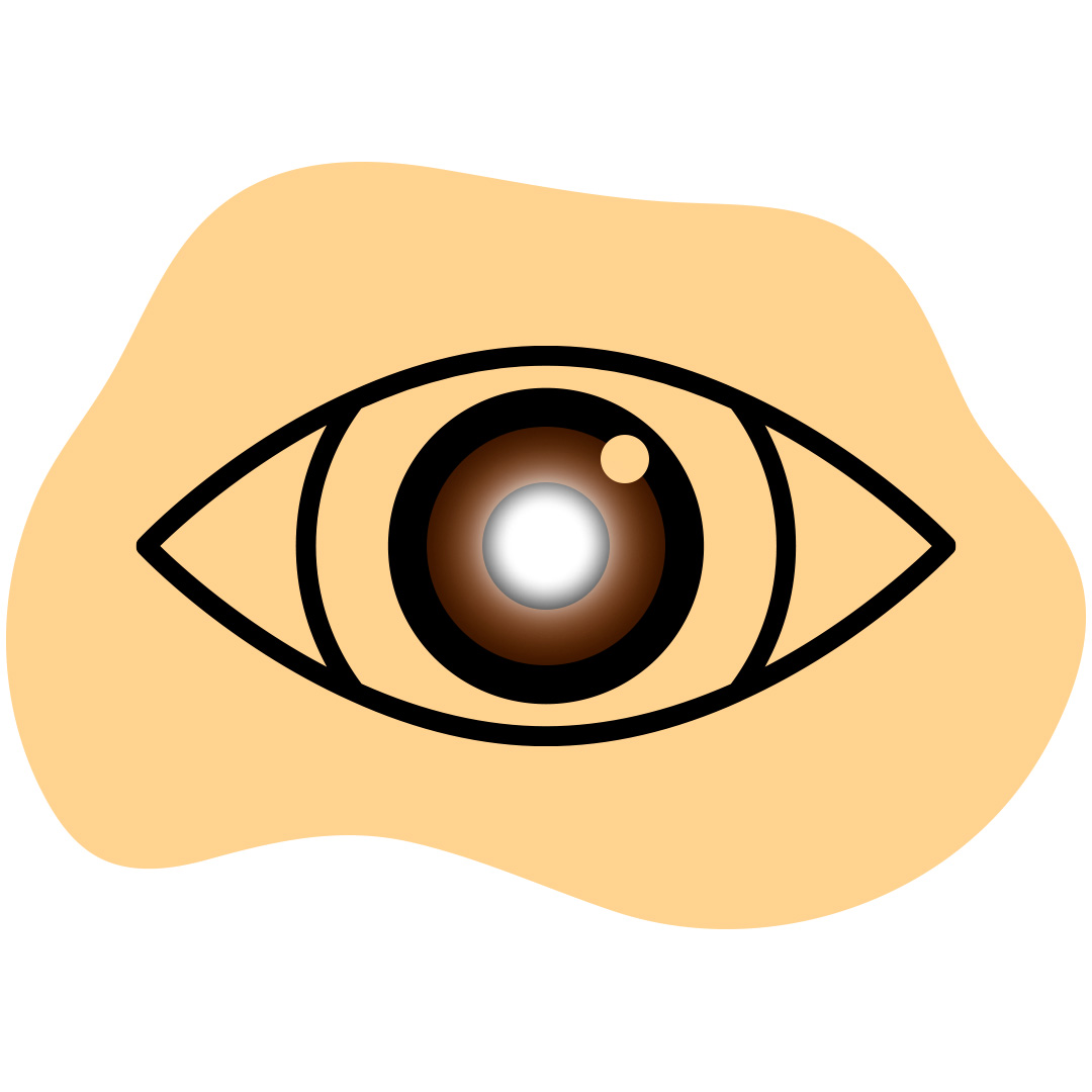 Glaucoma