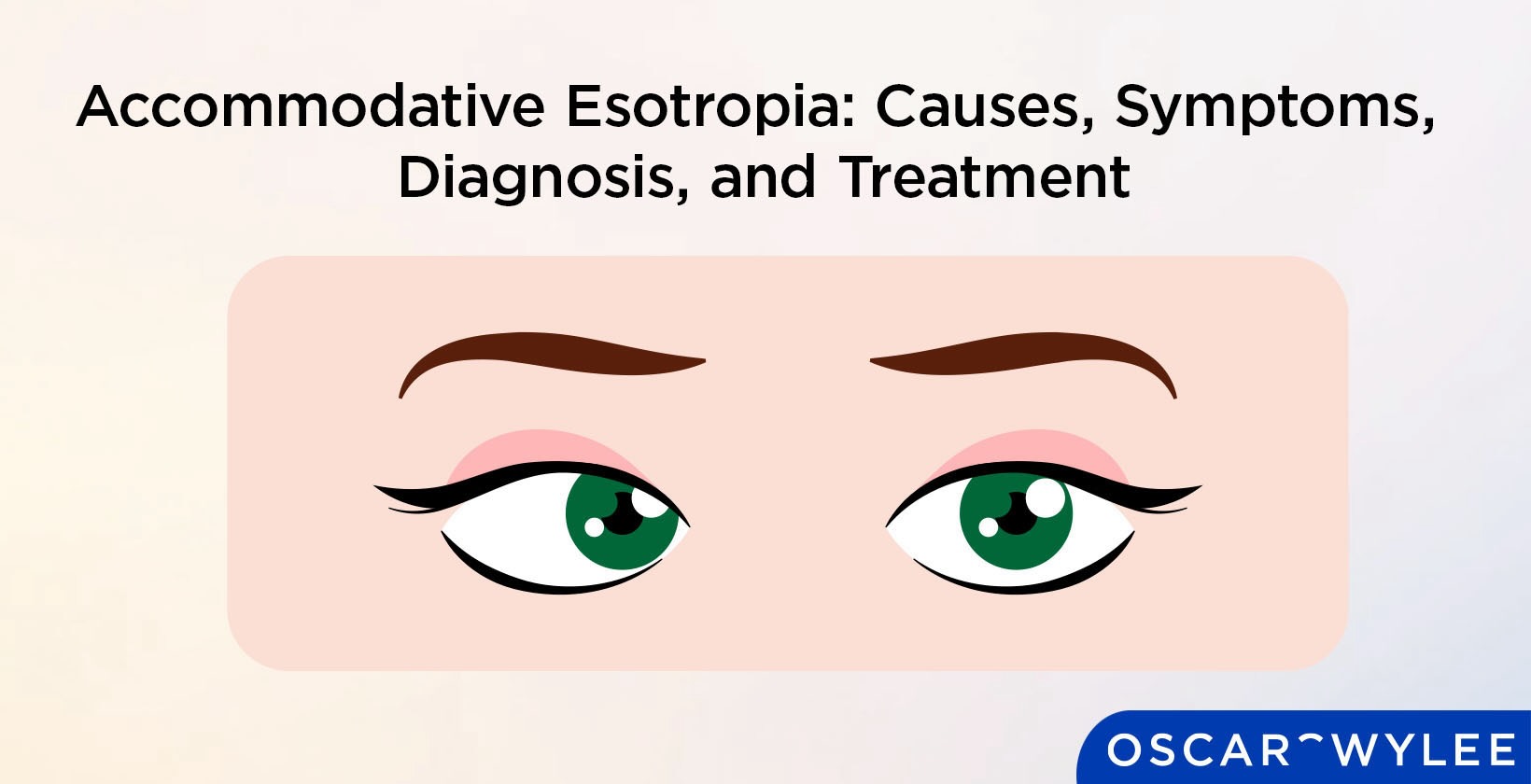 Accommodative Esotropia