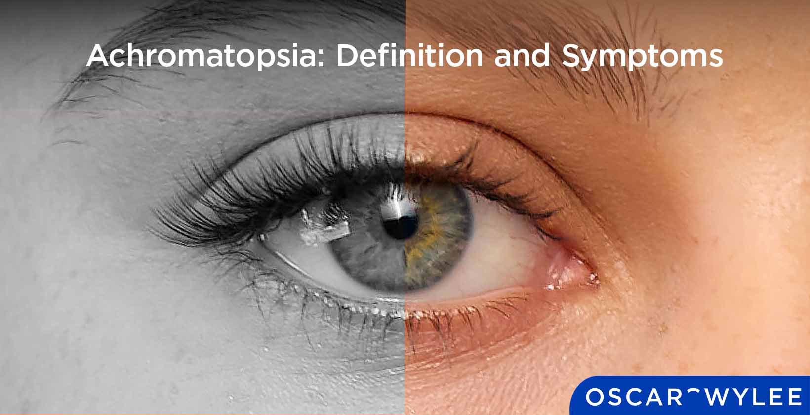 Achromatopsia: Definition and Symptoms