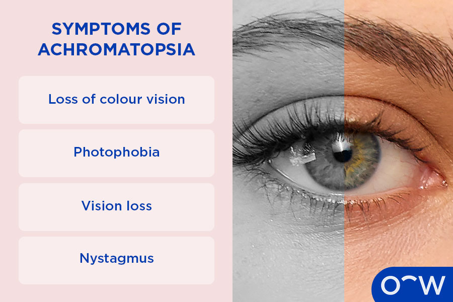 A photo of an eye: half in colour and half greyscale. Symptoms listed to side: loss of colour vision, photophobia, vision loss and nystagmus.