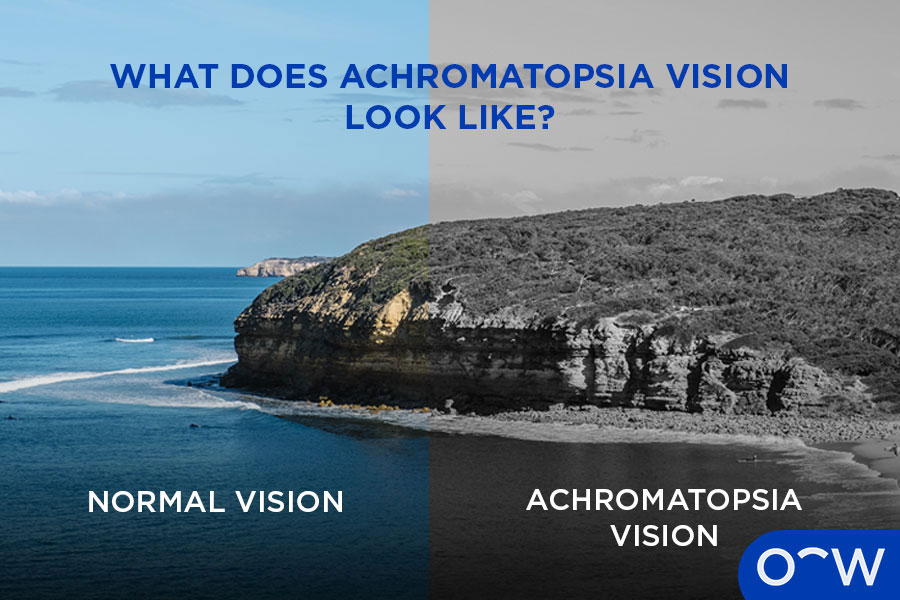 An image showing 'normal vision' on the left hand side and 'Achromatopsia vision' in the right hand side.