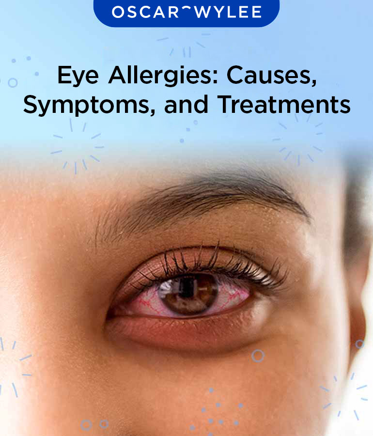 Eye Allergies: Causes, Symptoms, and Treatments