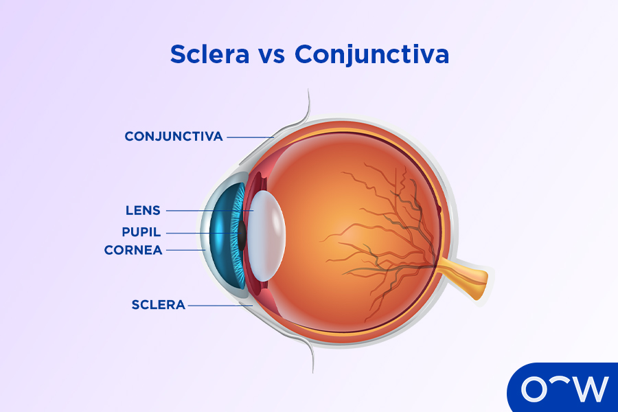 A diagram of the eyeball labelling the conjunctiva and the sclera.