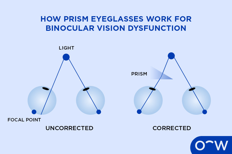 Illustrated diagram of prism glasses bending light correctly.