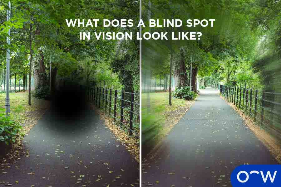 A photo of two ways in which blind spots in the vision look like: a dark spot and distorted zig zags