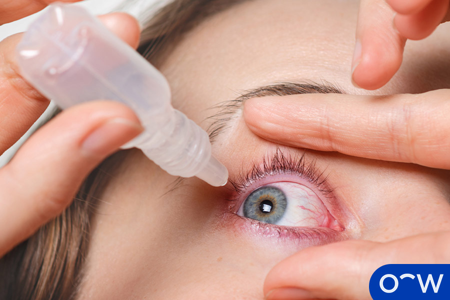 Treating with eye drops