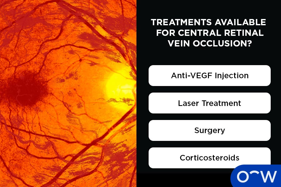 Treatment options for central retinal vein occlusion
