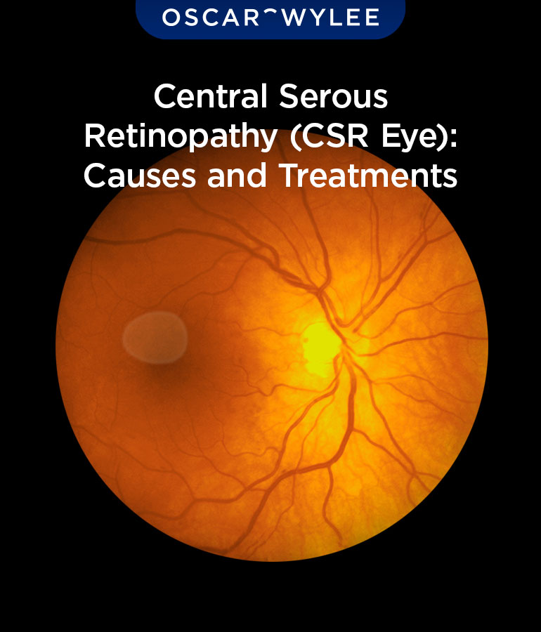 Central Serous Retinopathy