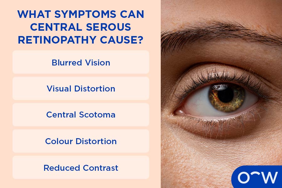 An infographic naming the symptoms of Central Serous Retinopathy: blurred vision, visual distortion, central scotoma, colour distortion and reduced contrast.
