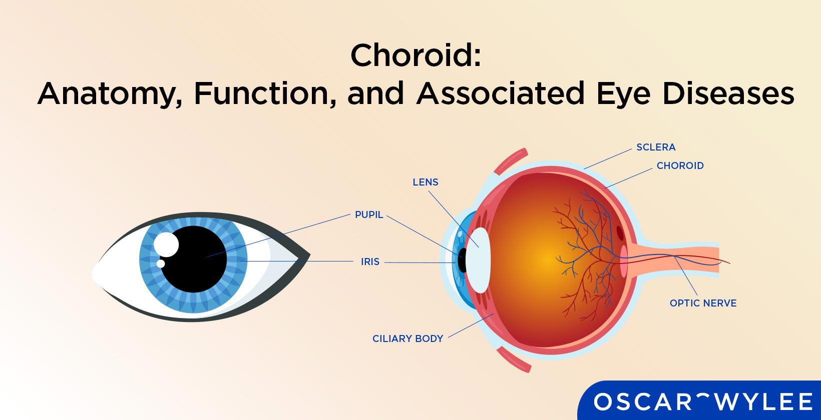 Choroid