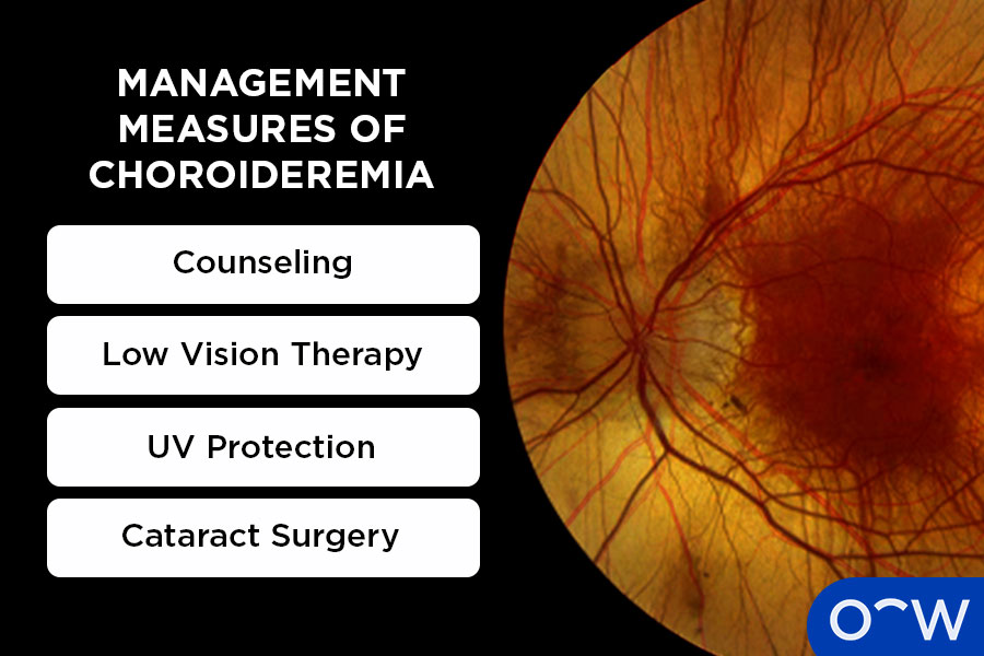 Graphic displaying options that can help manage choroideremia.