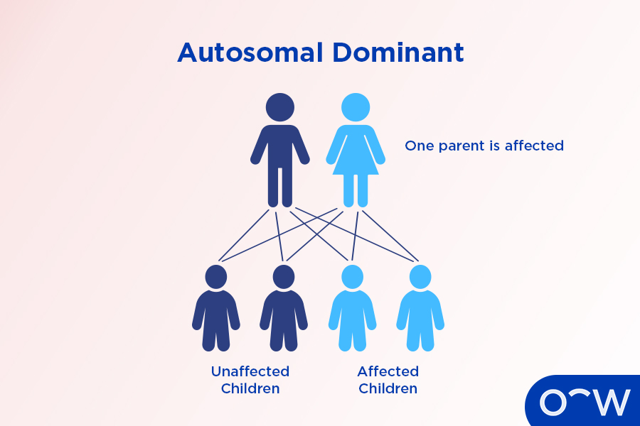 Diagram shows the genetic pathway, autosomal dominant, which is how Fuchs’ Dystrophy can be inherited.