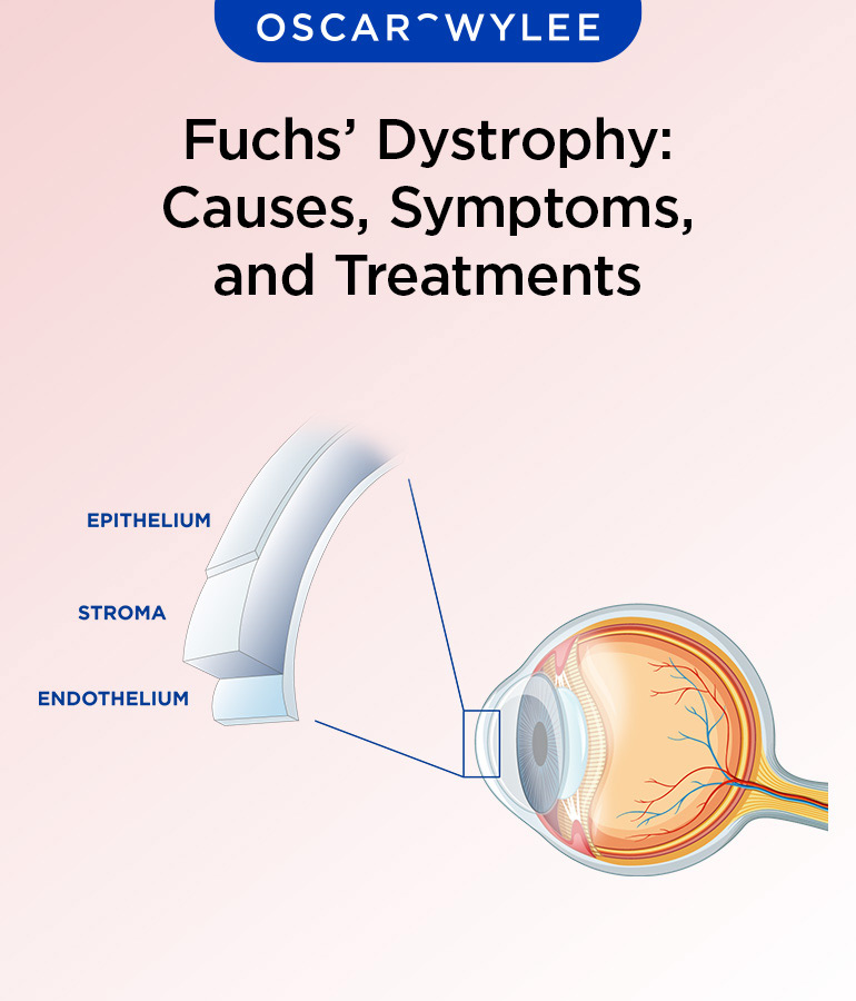 Fuchs' Dystrophy