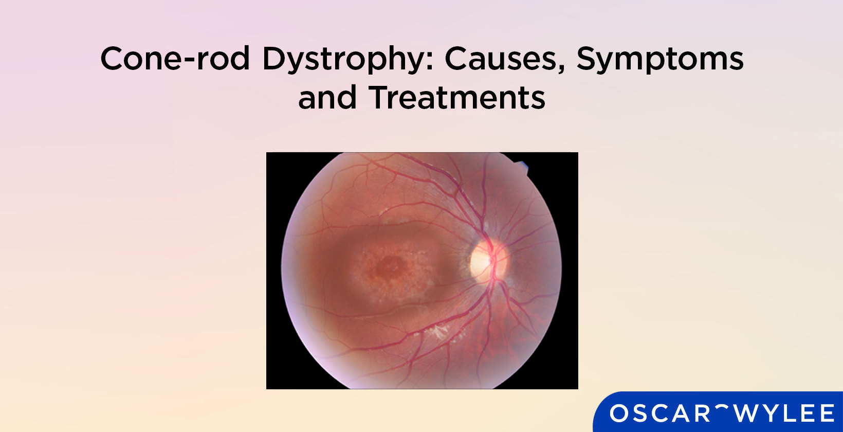 Cone-rod Dystrophy