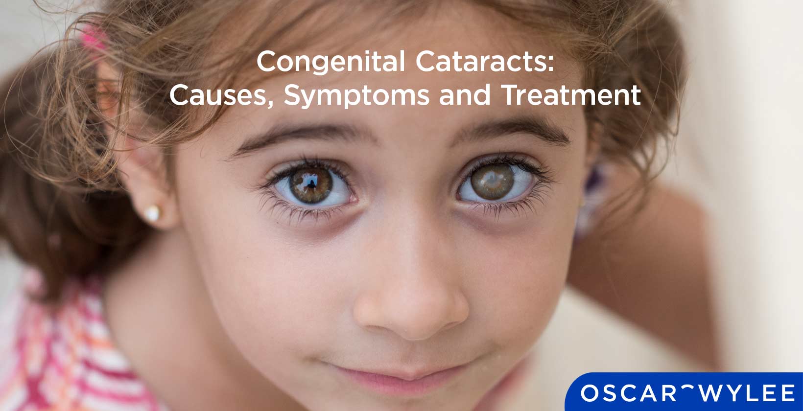 Congenital Cataracts