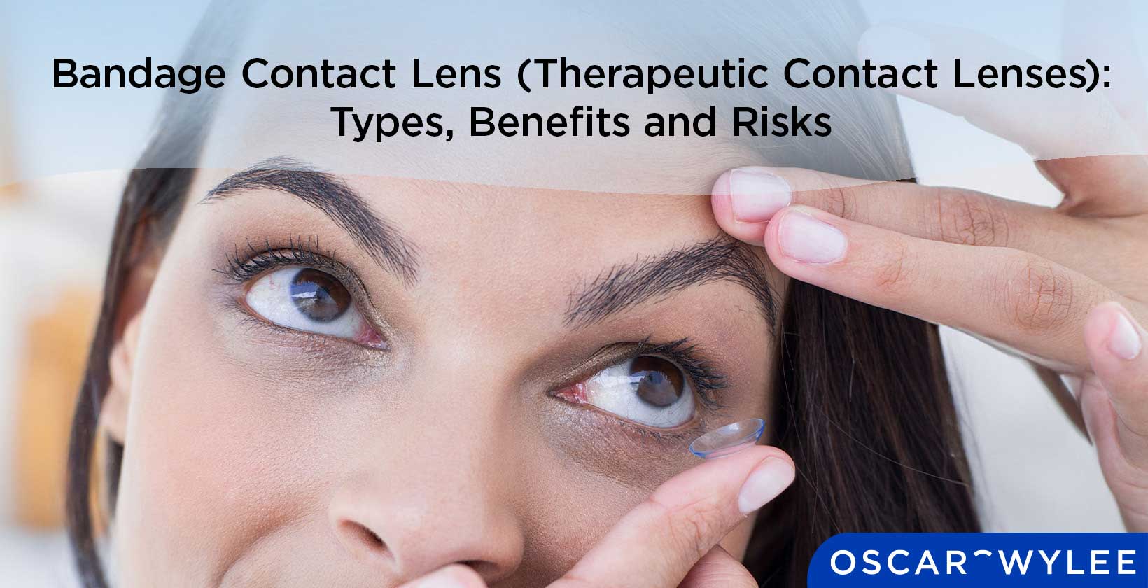 Therapeutic Contact Lenses