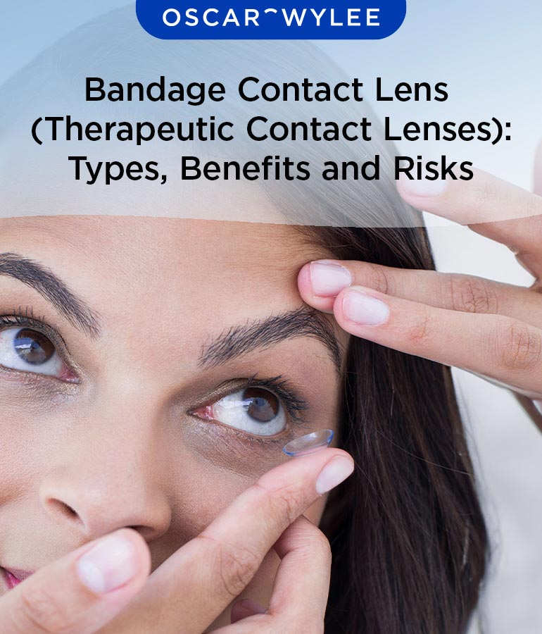 Therapeutic Contact Lenses