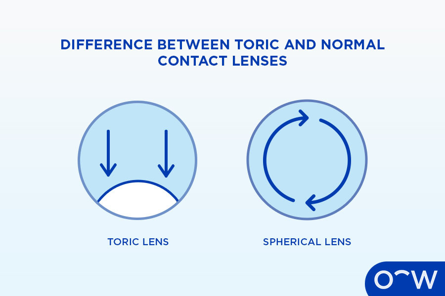 What Is the Difference Between Toric and Normal Contact Lenses?