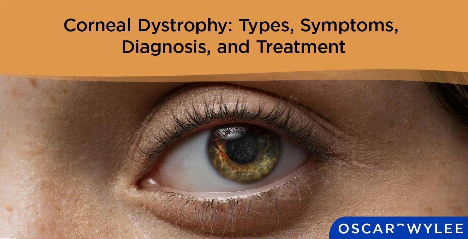 Corneal Dystrophy