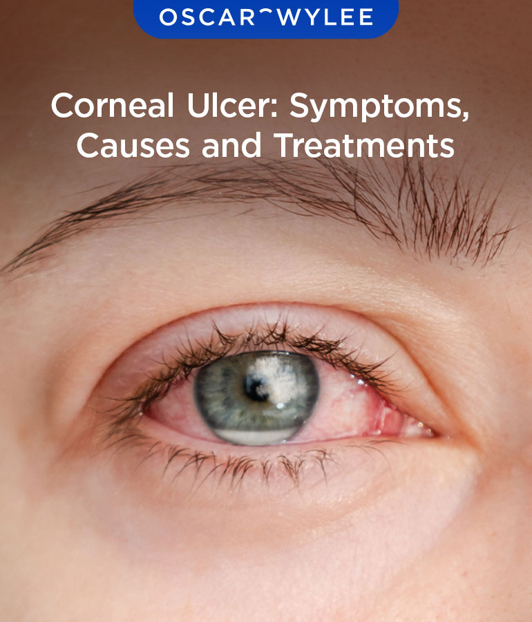 Corneal Ulcer