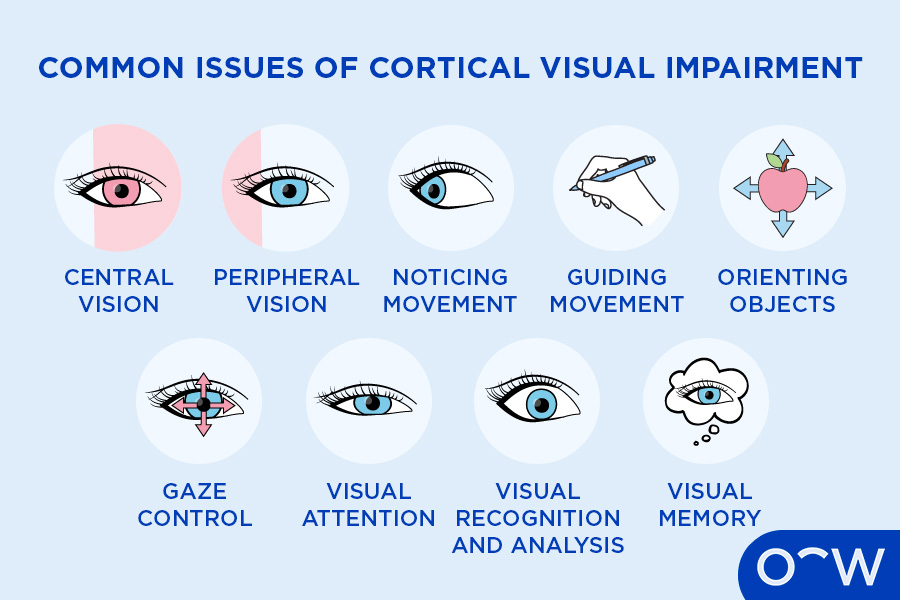 Different eye exercises for visual impairment symptoms