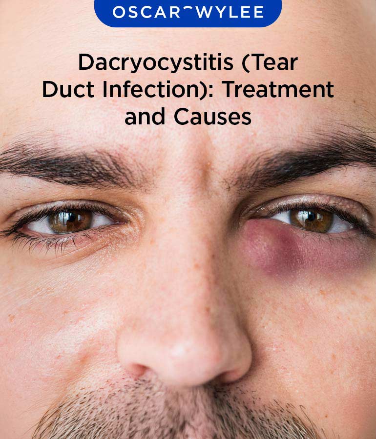 Dacryocystitis (Tear Duct Infection): Treatment and Causes