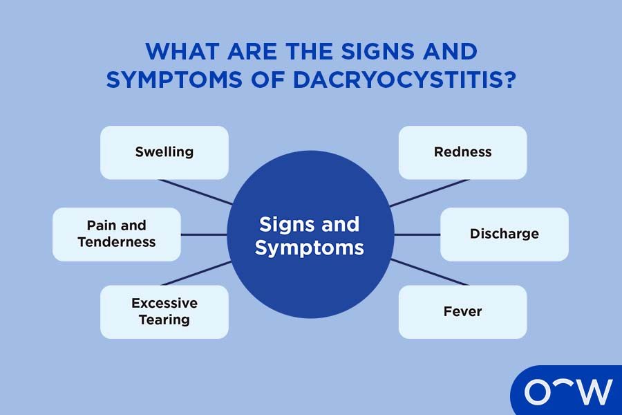 Infographic explaining the signs and symptoms of dacryocystitis