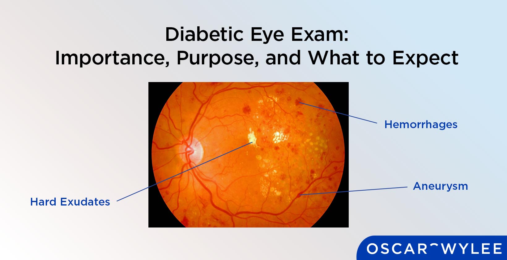 Diabetic Eye Exam: Why It Matters