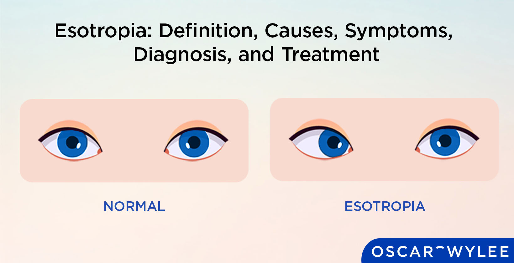 Esotropia