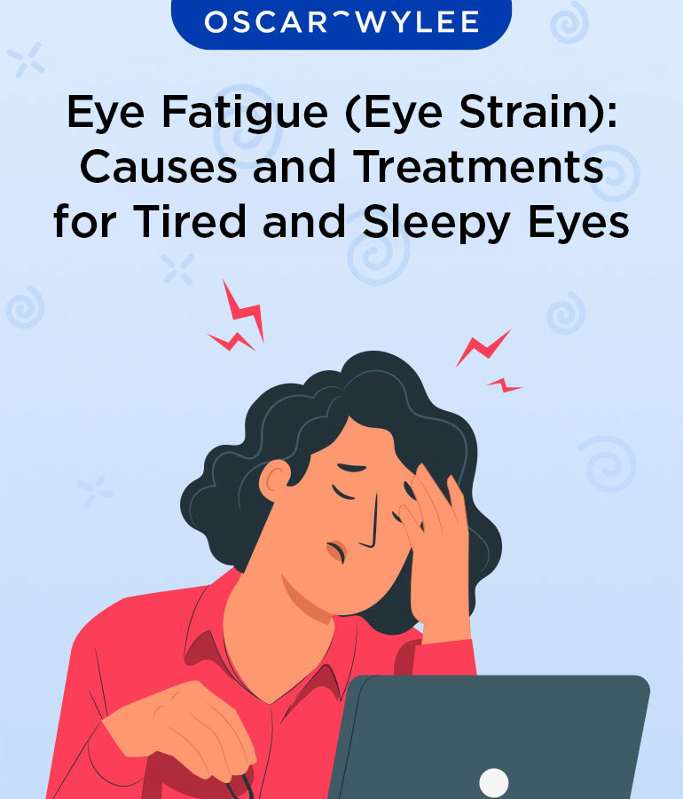Eye Fatigue (Eye Strain): Causes and Treatments for Tired and Sleepy Eyes