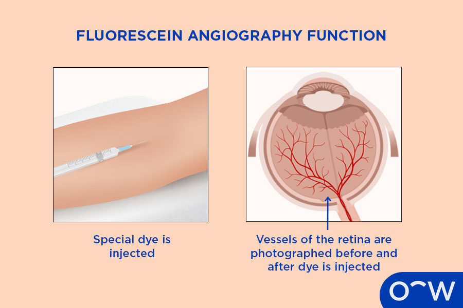 Arm shown with an injection being inserted and eyeball with veins