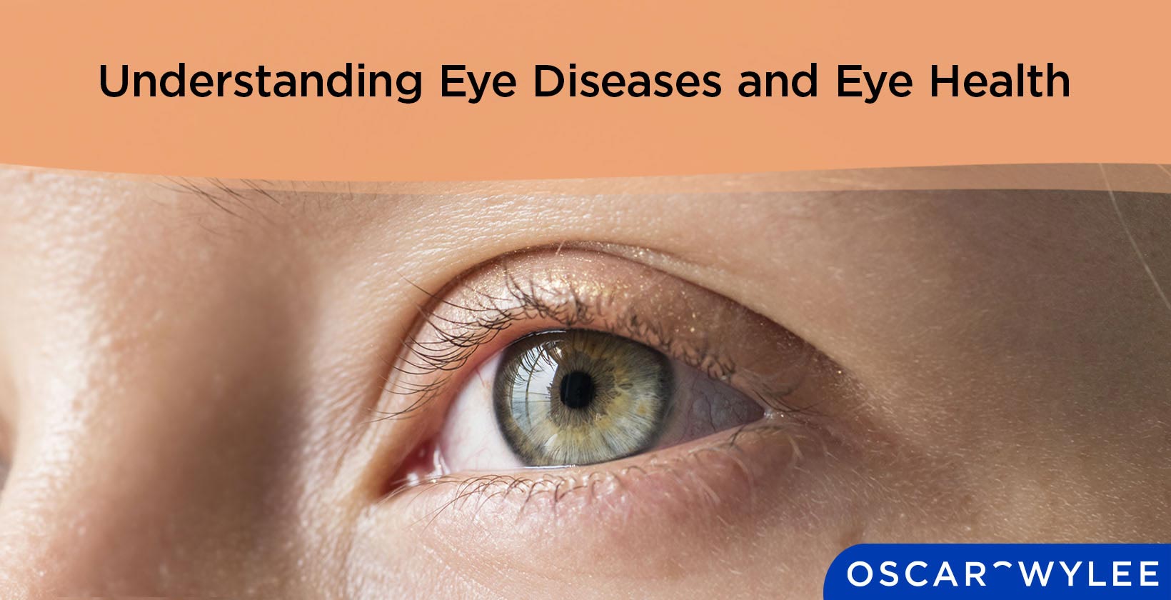 Eye Diseases and Health