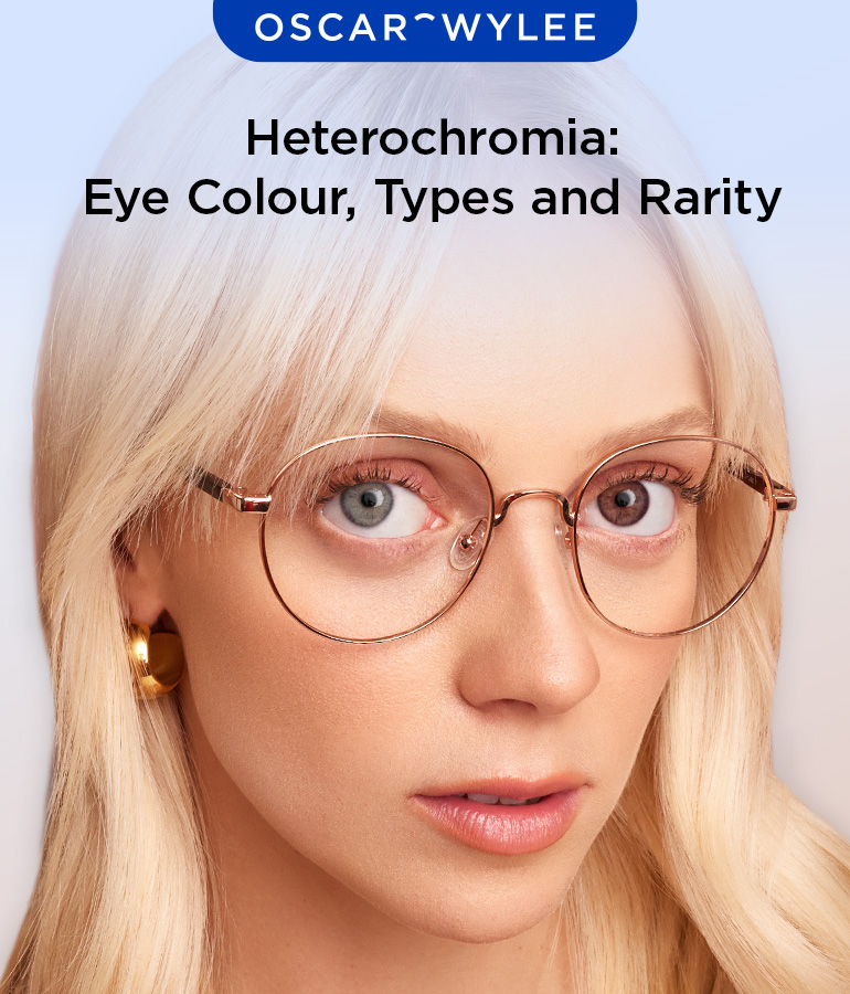 What Is Heterochromia?