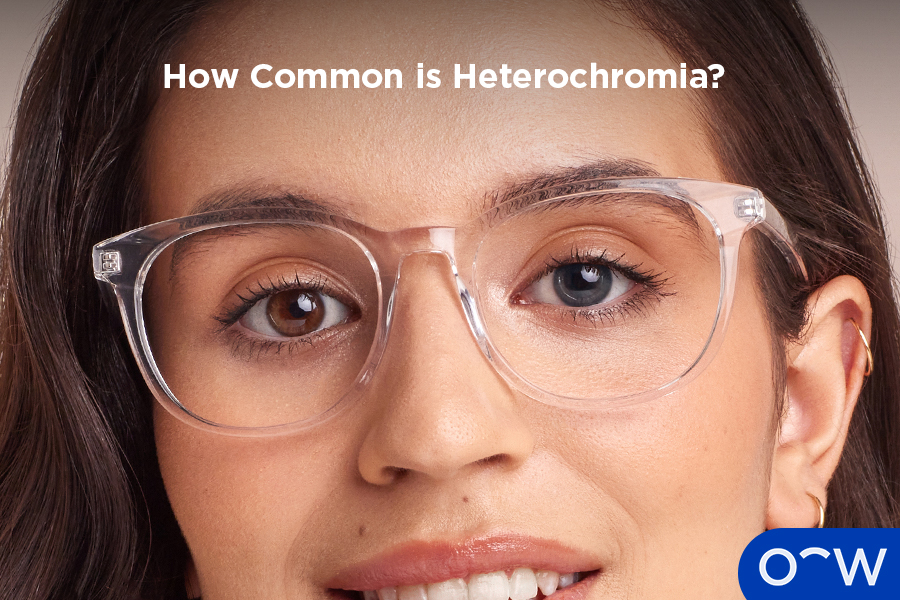 A person with complete heterochromia, or two different coloured eyes.