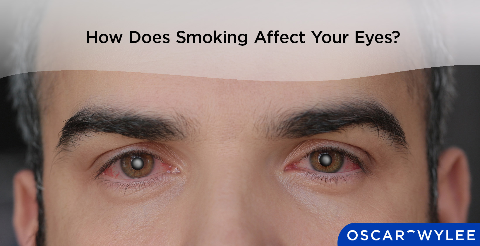 How Does Smoking Affect Eye Health?
