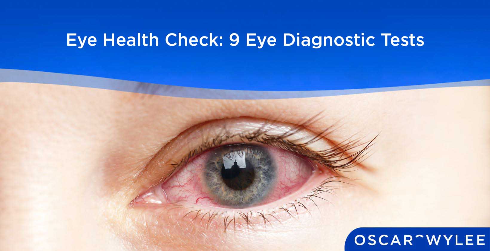 Eye Health Check: 9 Eye Diagnostic Tests