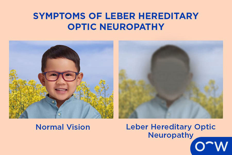 Two side-by-side images of a boy wearing a blue shirt in front of a field of yellow flowers. The left image is focused, and the right image is blurred.