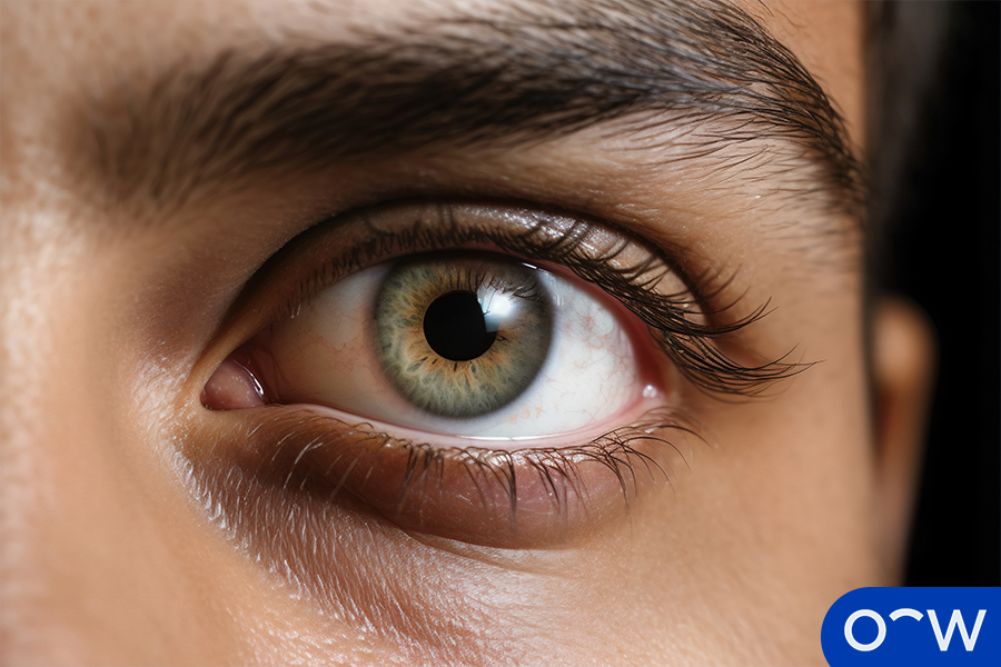 A close-up of an eye