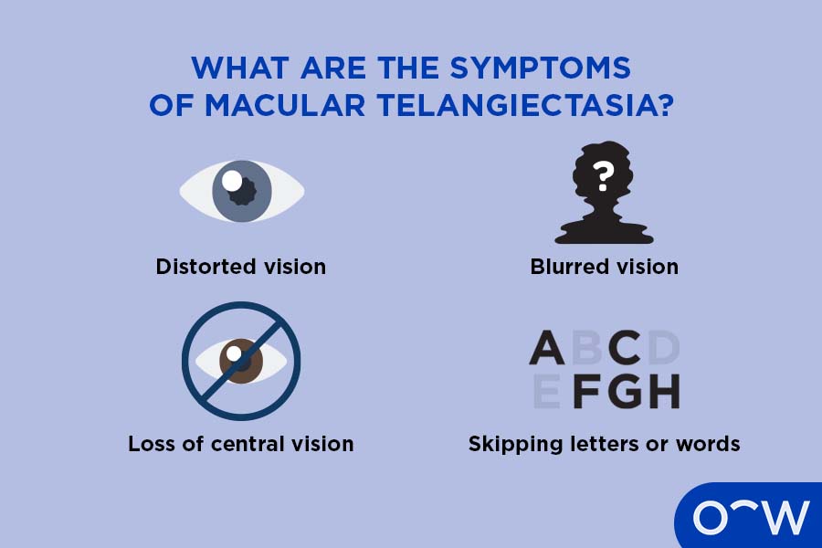 Illustration depicting different symptoms of macular telangiectasia