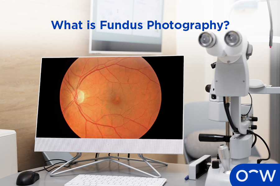 A fundus photograph of an eye on a monitor.