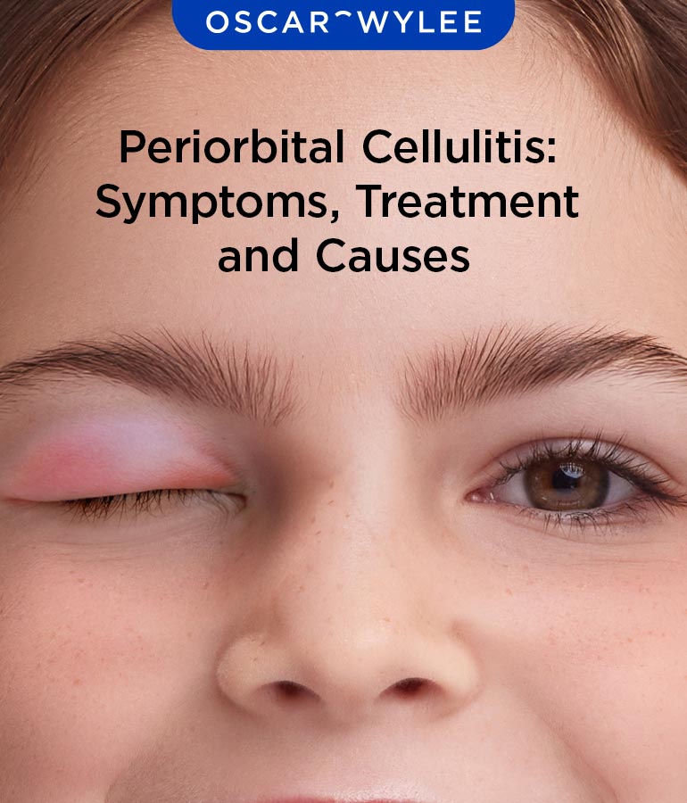 Periorbital Cellulitis: Symptoms, Treatment and Causes