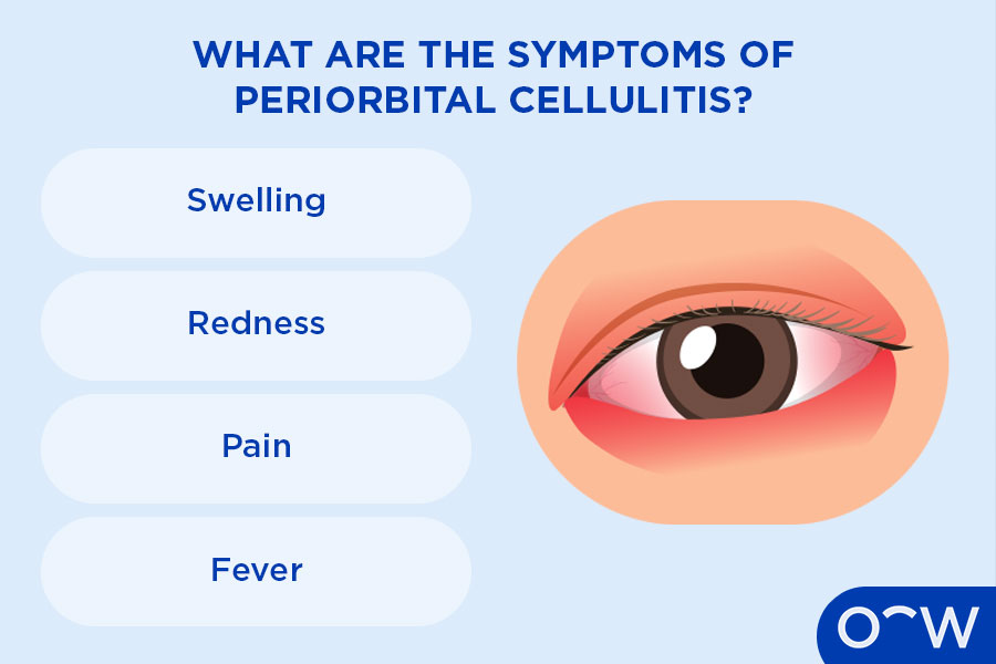 Infographic outlining periorbital cellulitis symptoms