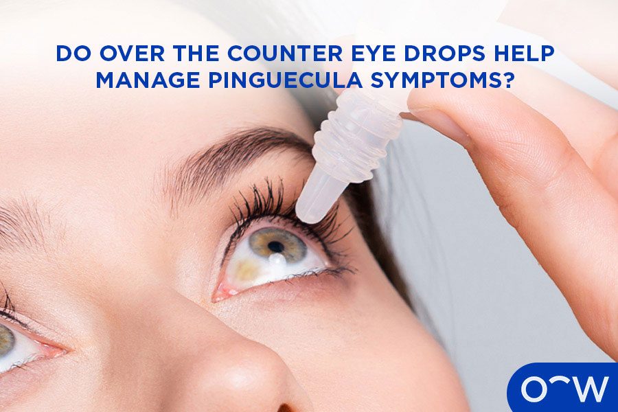 Image of a patient with a pinguecula using eye drops