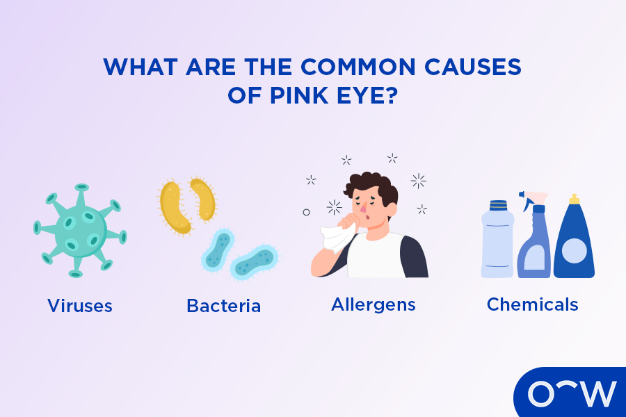 Infographic showing causes of pink eye