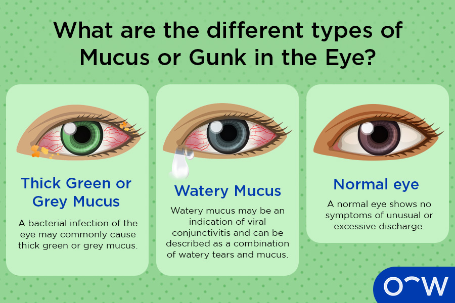 What are the different types of Mucus or Gunk in the Eye?