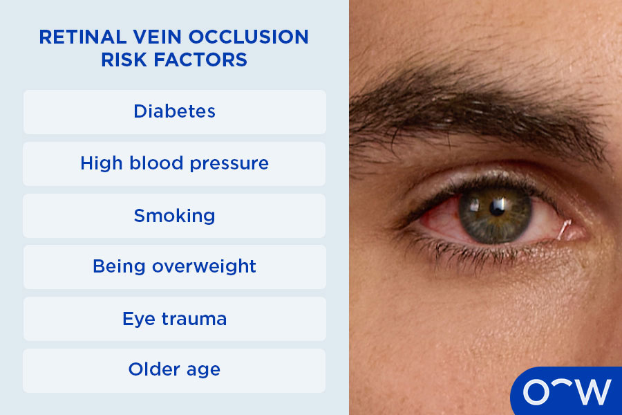 An explainer image detailing some of the conditions (diabetes, high blood pressure, eye trauma) that increase the risk of RTO, as well as a photo of an affected eye.