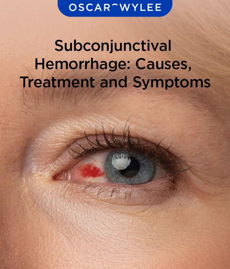 Subconjunctival Hemorrhage: Causes, Treatment and Symptoms