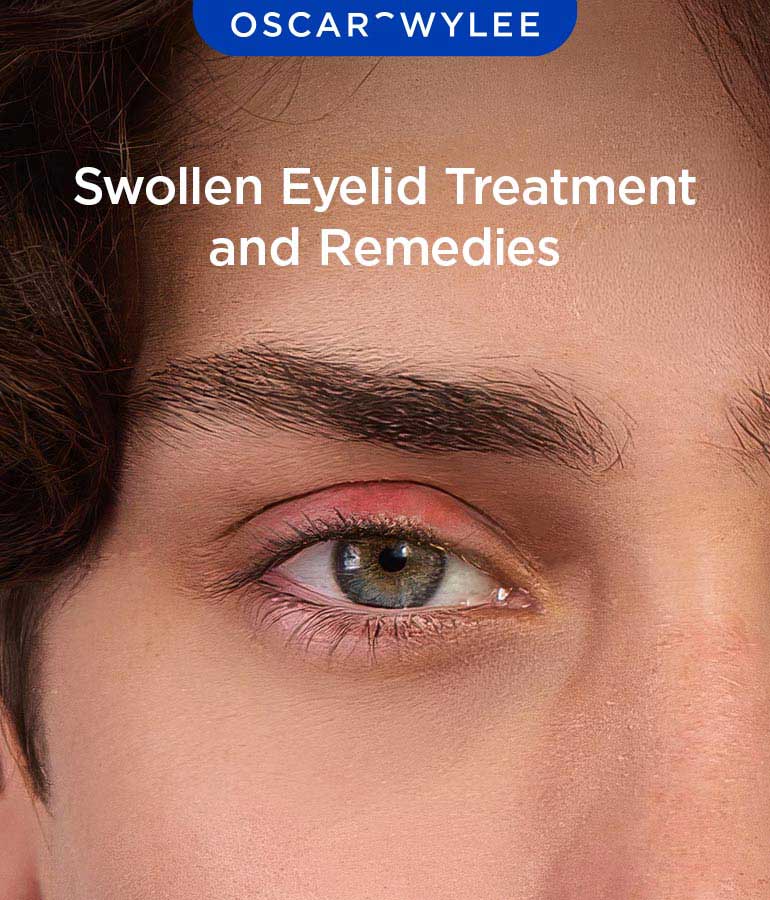 Swollen Eyelid Treatment and Remedies