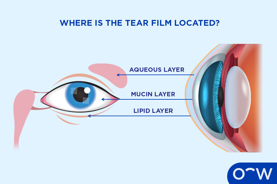 A diagram of the eye demonstrating where the tear film and its layers are located.