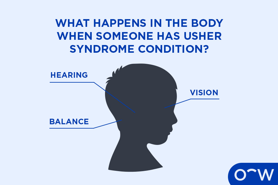 An animated photo of a child’s head with arrows labelling ‘hearing,’ ‘vision’ and ‘balance’ which are three parts of the body affected by Usher Syndrome.